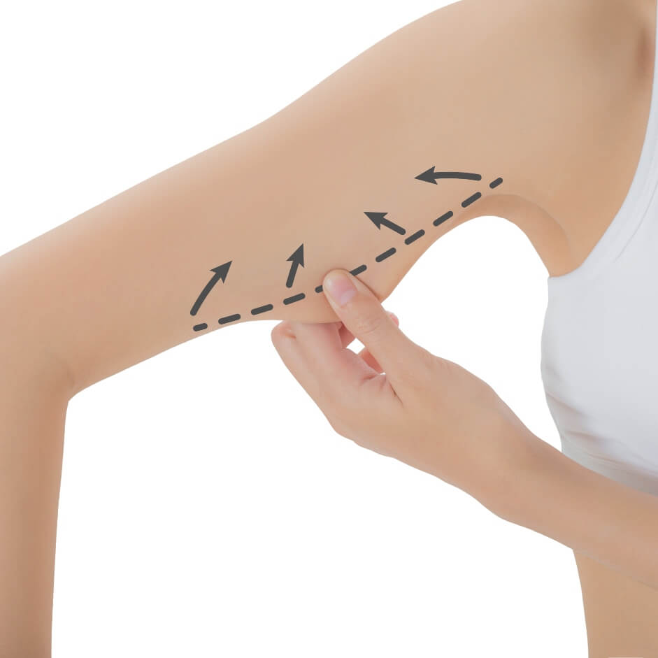 firming-arm-firming-dra-anton-1